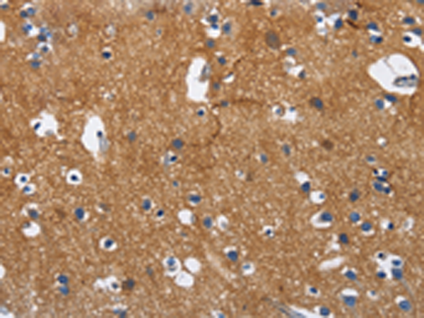 Rabbit Polyclonal Antibody to CADM3