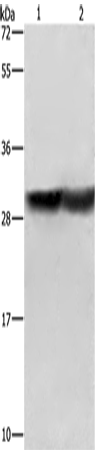 Rabbit Polyclonal Antibody to CALB1