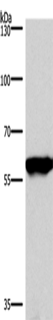 Rabbit Polyclonal Antibody to PPP3CA