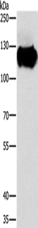 Rabbit Polyclonal Antibody to CAST
