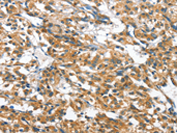 Rabbit Polyclonal Antibody to CASQ2