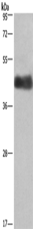 Rabbit Polyclonal Antibody to CALU