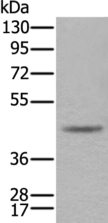 Rabbit Polyclonal Antibody to CAMK1D