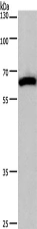 Rabbit Polyclonal Antibody to CAMK4