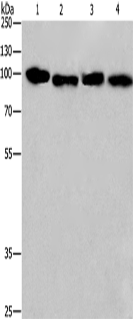 Rabbit Polyclonal Antibody to CANX