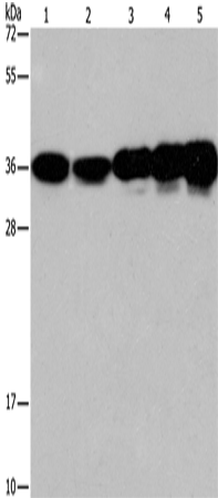 Rabbit Polyclonal Antibody to CAPZA2