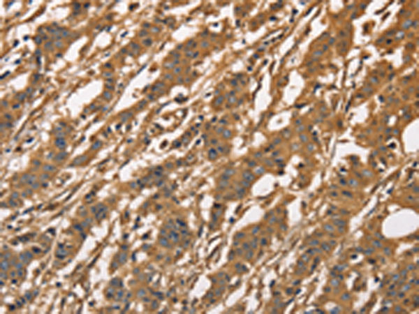 Rabbit Polyclonal Antibody to CAPZA3