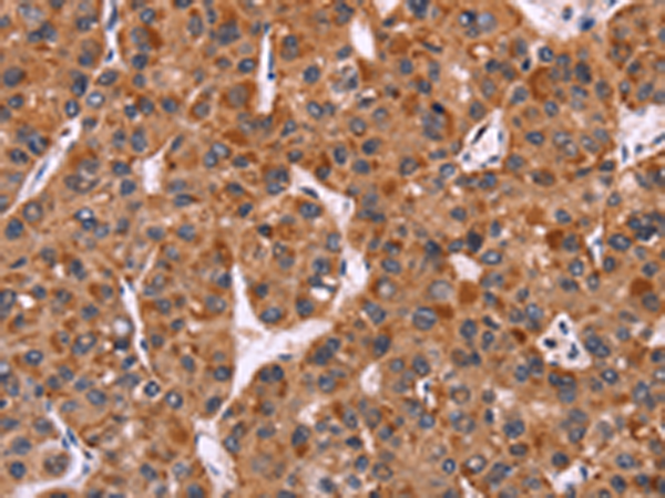 Rabbit Polyclonal Antibody to CARD11