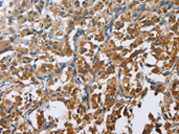 Rabbit Polyclonal Antibody to CARD9