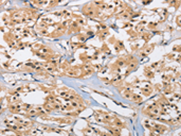 Rabbit Polyclonal Antibody to CARD8