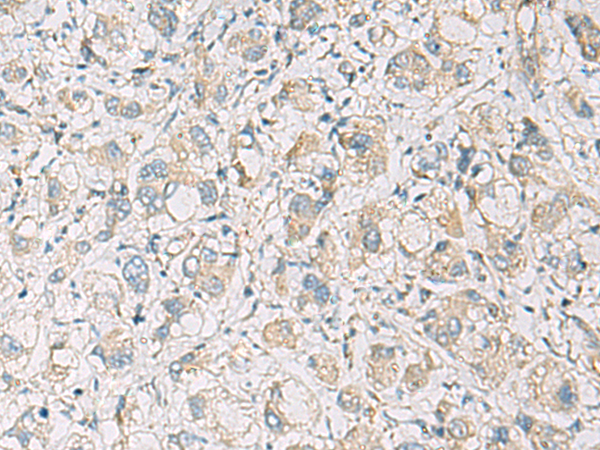 Rabbit Polyclonal Antibody to NLRC4