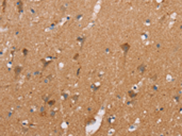 Rabbit Polyclonal Antibody to CASC3