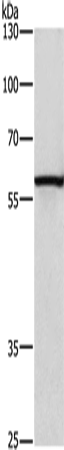 Rabbit Polyclonal Antibody to CAT