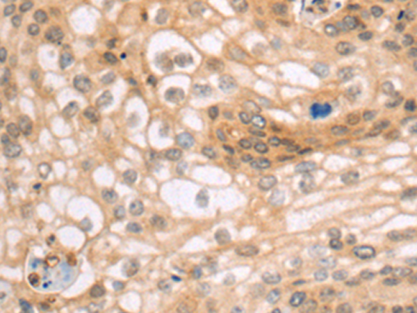 Rabbit Polyclonal Antibody to CATSPER1