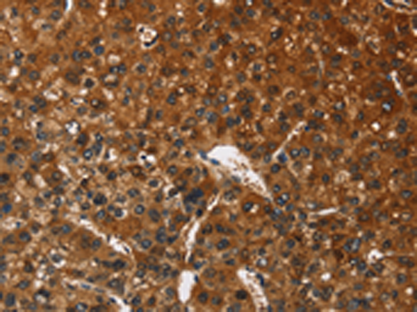 Rabbit Polyclonal Antibody to CATSPER4