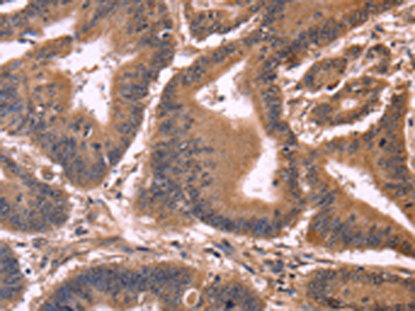 Rabbit Polyclonal Antibody to CCDC106