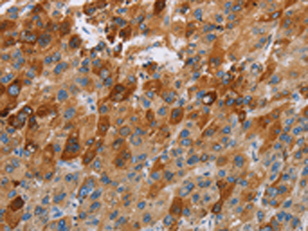 Rabbit Polyclonal Antibody to CCR9