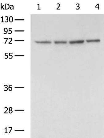 Rabbit Polyclonal Antibody to IL2RB