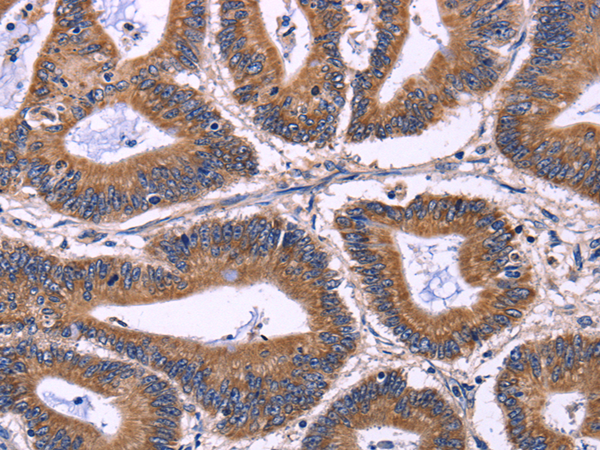 Rabbit Polyclonal Antibody to KIR2DL3