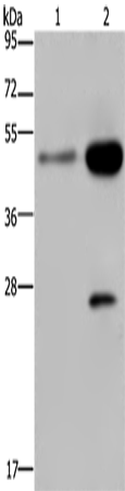 Rabbit Polyclonal Antibody to CD160