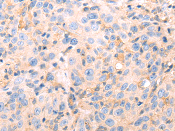 Rabbit Polyclonal Antibody to KLRB1