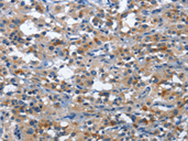 Rabbit Polyclonal Antibody to CD177