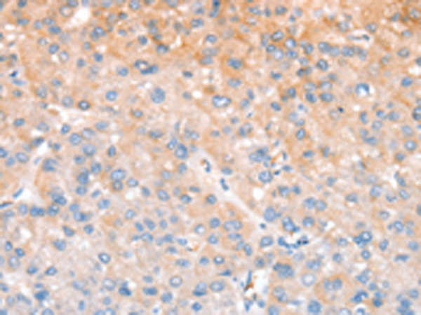 Rabbit Polyclonal Antibody to CXCR4