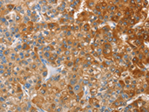 Rabbit Polyclonal Antibody to CD200R1