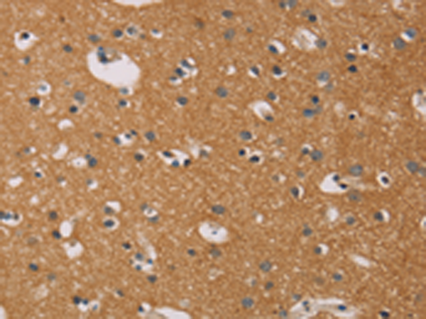 Rabbit Polyclonal Antibody to CD22