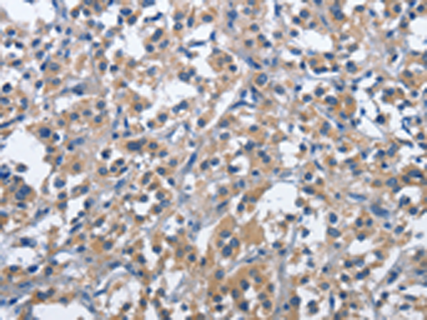 Rabbit Polyclonal Antibody to CD244