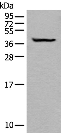 Rabbit Polyclonal Antibody to BTLA