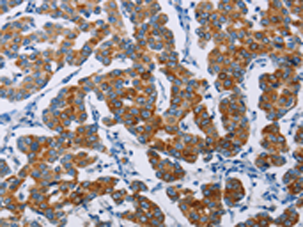 Rabbit Polyclonal Antibody to NCR3