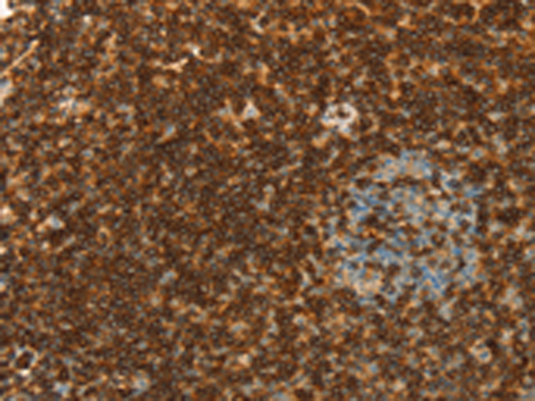 Rabbit Polyclonal Antibody to SPN