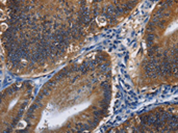 Rabbit Polyclonal Antibody to CD46