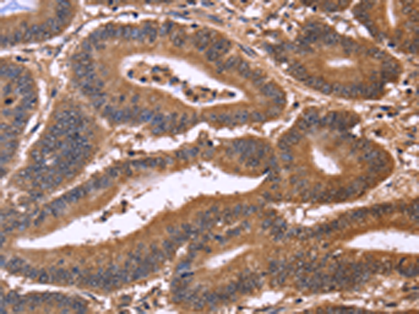 Rabbit Polyclonal Antibody to CDC37L1