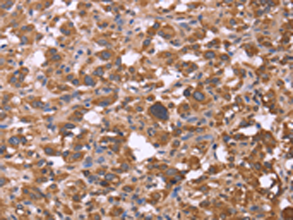 Rabbit Polyclonal Antibody to FBXW7