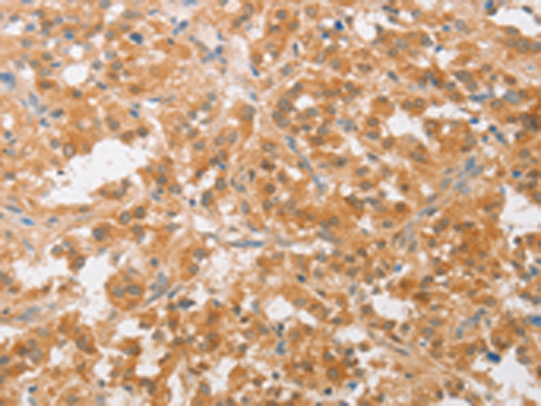 Rabbit Polyclonal Antibody to CDKN2C