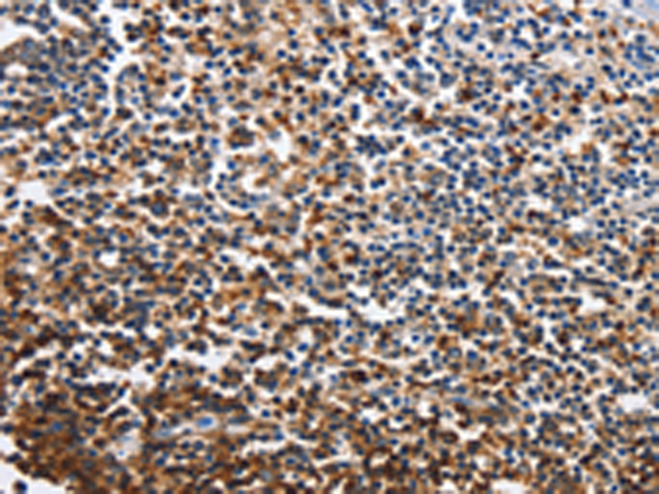 Rabbit Polyclonal Antibody to CDO1