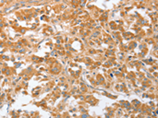 Rabbit Polyclonal Antibody to CDR2