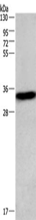 Rabbit Polyclonal Antibody to CENPP