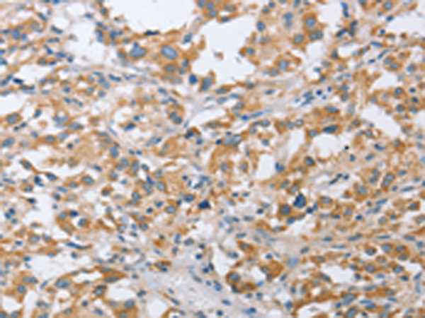 Rabbit Polyclonal Antibody to CENPO