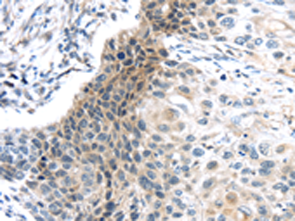 Rabbit Polyclonal Antibody to CENPM