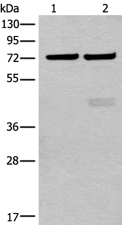 Rabbit Polyclonal Antibody to CETP