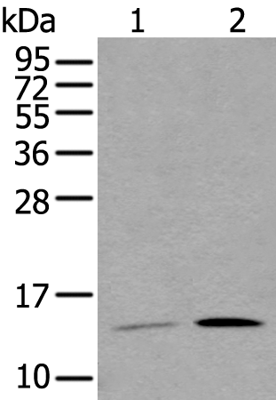 Rabbit Polyclonal Antibody to CGA