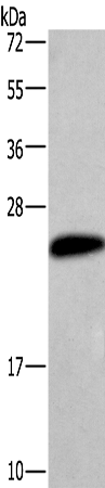 Rabbit Polyclonal Antibody to CGB3