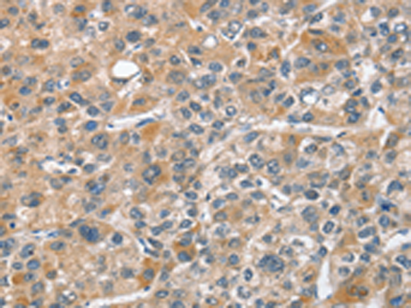 Rabbit Polyclonal Antibody to CHMP4B