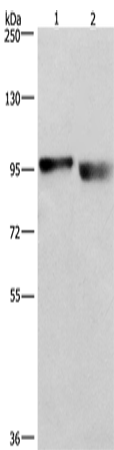Rabbit Polyclonal Antibody to CIP2A