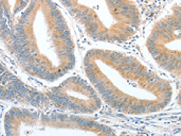 Rabbit Polyclonal Antibody to CKAP2