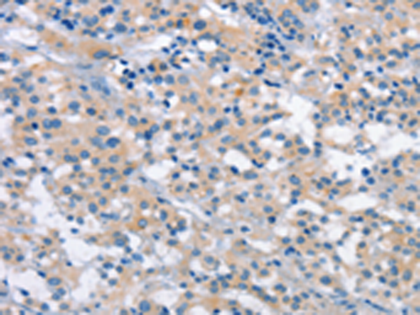 Rabbit Polyclonal Antibody to PLEKHO1