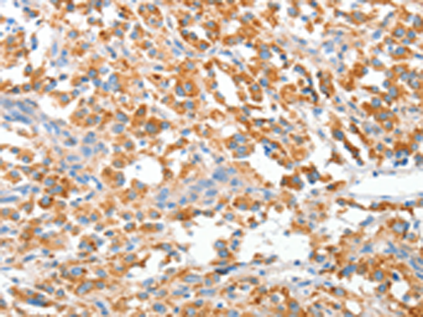 Rabbit Polyclonal Antibody to CLIP1
